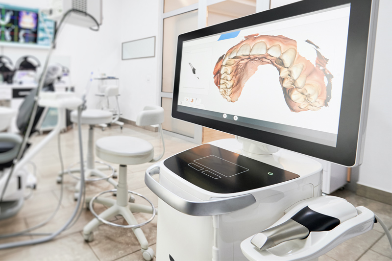 Intra-Oral Scanner in Charlotte